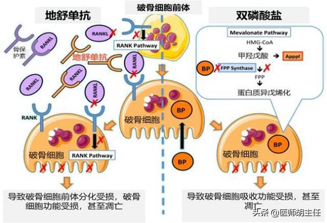 最新骨转针技术，重塑骨骼健康的革命性工具，引领未来治疗新篇章